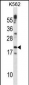 CTF1 Antibody (C-term)